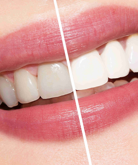 Kids Dentist Near me