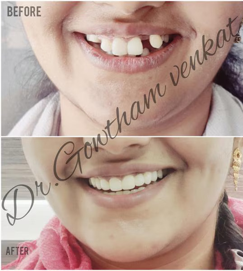 Paediatric Dentist in Vadapalani, Chennai