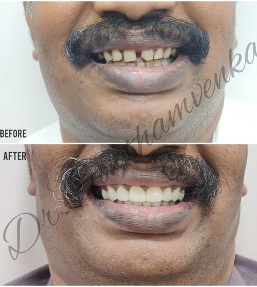 Dest Dentist Near Me