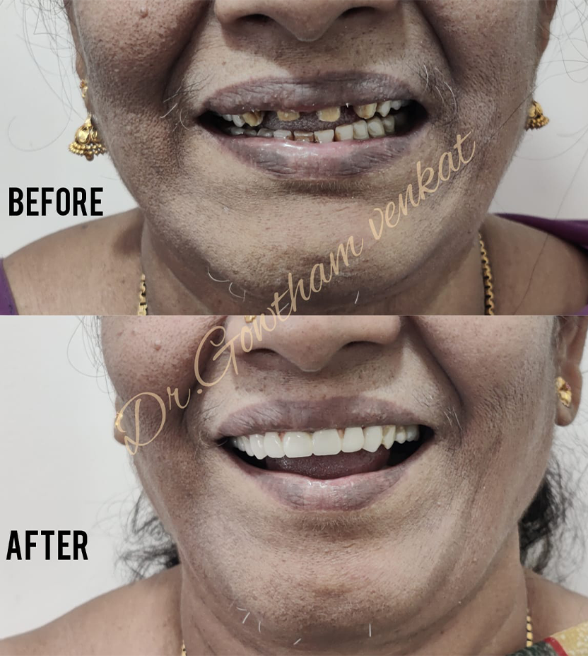 Best Dental Hospital in Vadapalani, Chennai