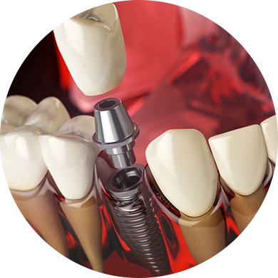 Best Dental Hospital in vadapalani, Chennai